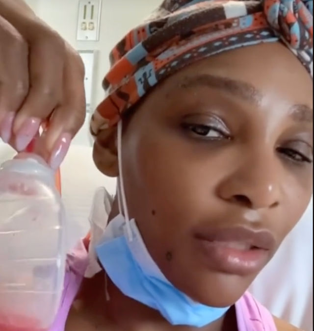 Serena Williams’ surgery shock: Grapefruit-sized cyst removed from neck